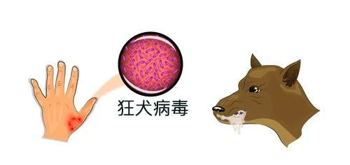 被狗咬了，一定要24小时内打狂犬病疫苗吗？